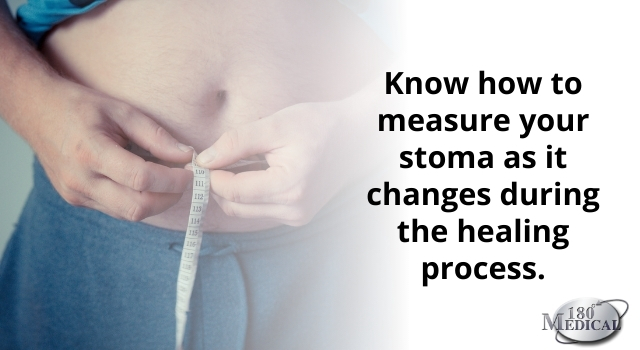 Learn how to measure your stoma during the healing process