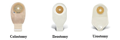 ostomy supplies